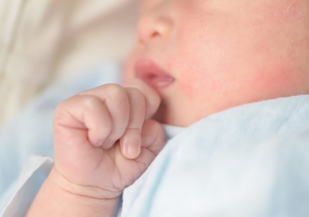Ruam di Lipatan Bayi? Kenali Penyebab dan Cara Mengatasinya