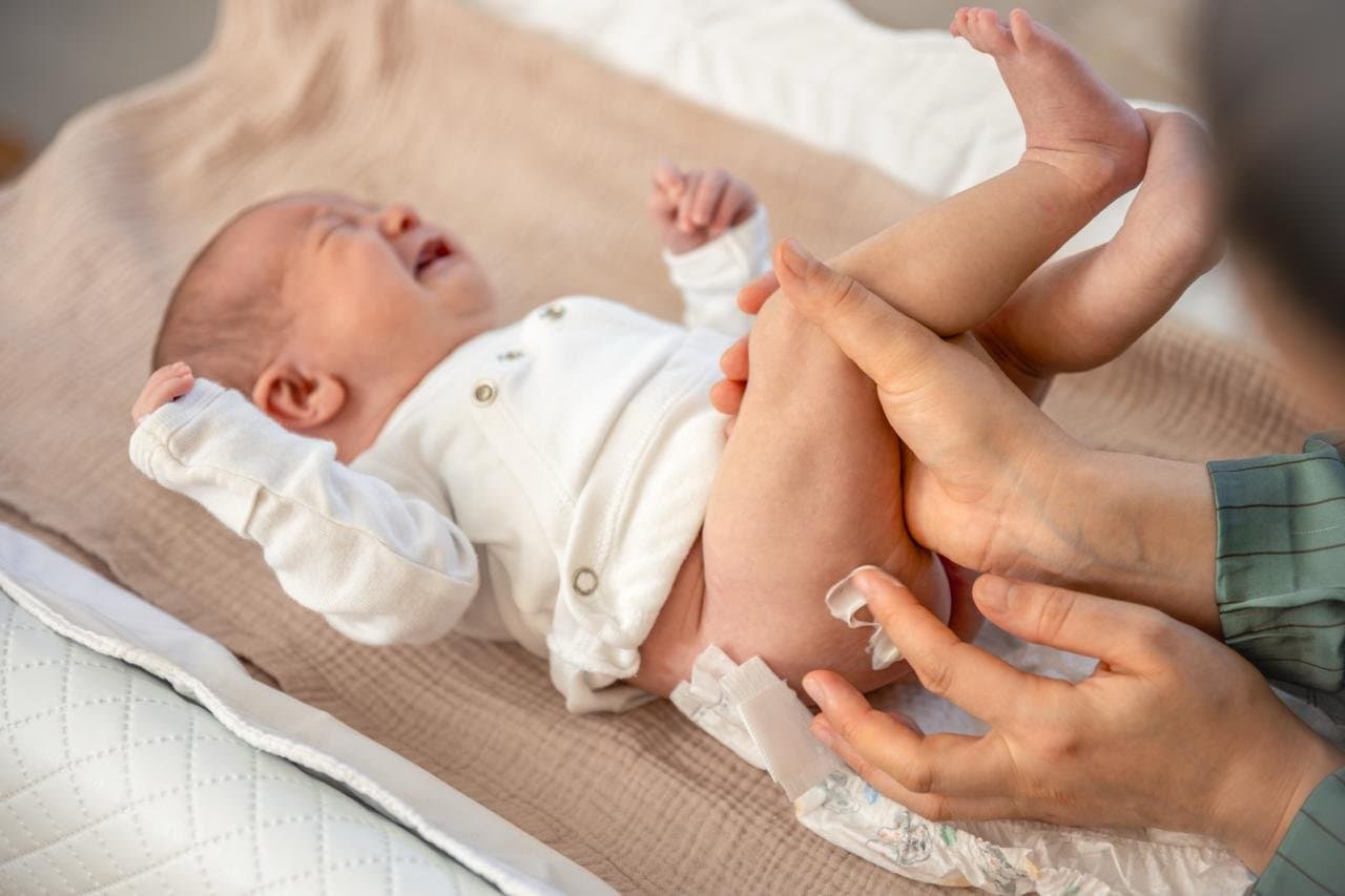 Bayi Sering Mengejan Saat BAB? Kenali Baby Grunting Syndrome